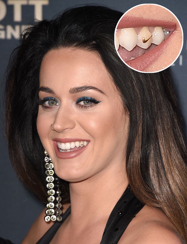 Katy Perry's Been Wearing Gold Tooth Jewellery For Over A Year & Nobody ...